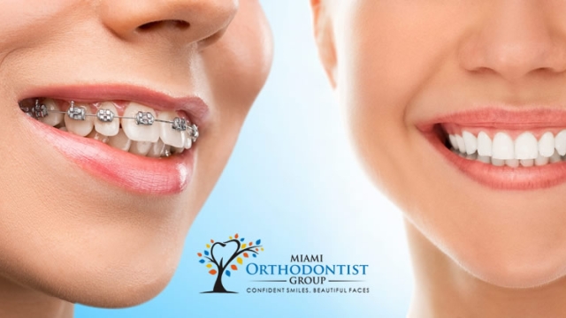 Straightening Smiles: Unveiling the Orthodontic Magic!